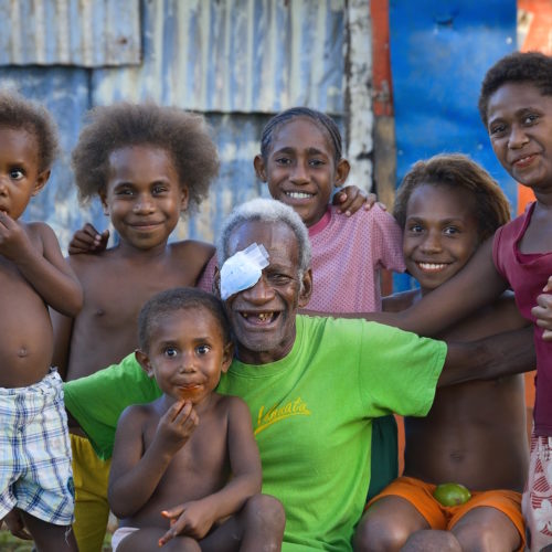 A man with kids and family members with an eye patch on his left eye